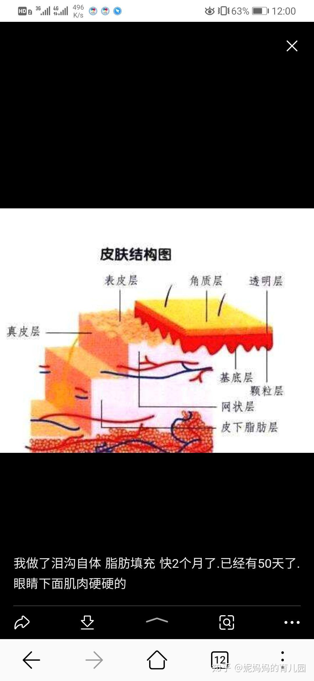 脂肪填充多久可以洗脸用洗面奶究竟脸部脂肪填充的危害如何护理