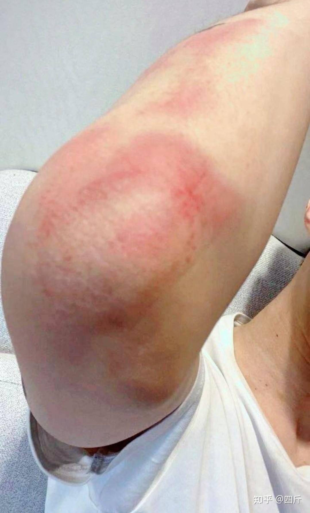 范丞丞拍戏受伤被导演刘信达表扬夸赞其亲自反复去摔是个爷们