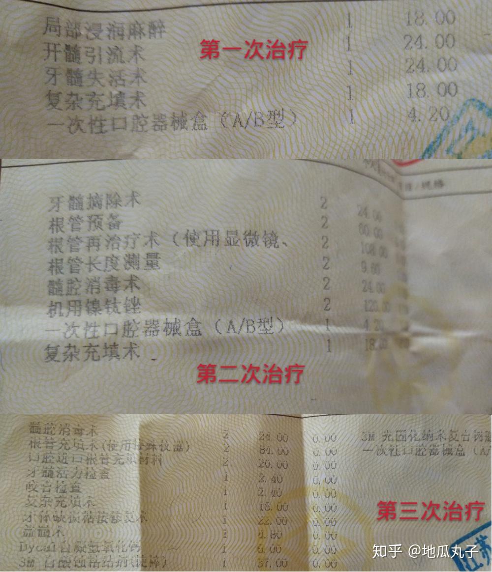 有牙髓炎是一种什么样的经历