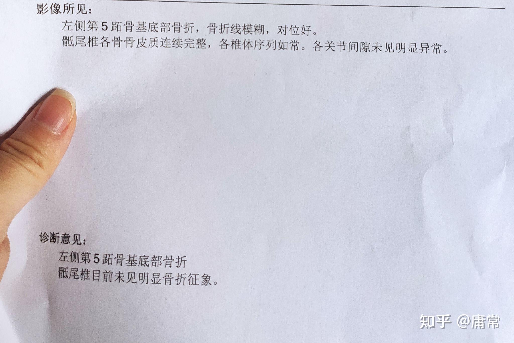 左侧第五跖骨基底部撕脱性骨折记录贴