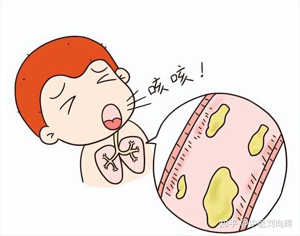 痰在哪，病在哪！中医教你用中成药，化解全身上下，五脏六腑之痰 - 知乎