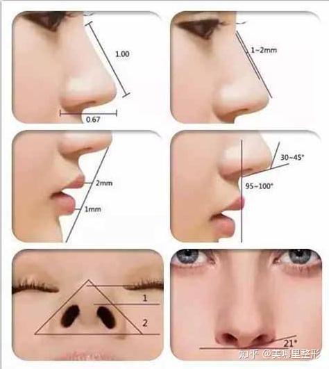 整形名医深圳博爱医院整形白云的韩式微创鼻综合整形