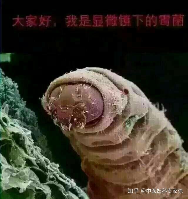 白带异常妇科疾病的前兆真的要注意到底是哪里出现了问题