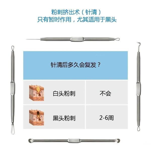一文说清【针清祛痘】的利与弊 - 知乎