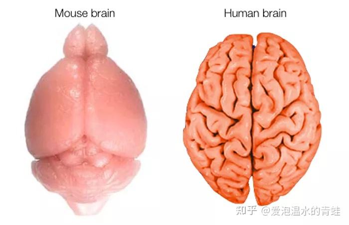 为什么人与人之间的智商不同?大脑结构有差异吗? 10 v2 82a35493311ddc73194882a84c5205f7 720w