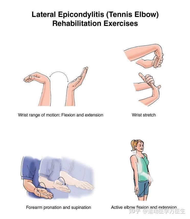 网球肘康复锻炼方法图图片