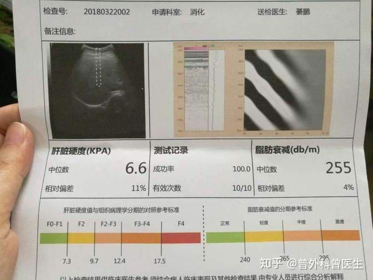 彈性成像可以判斷肝臟的硬度,肝臟越硬,提示肝纖維化和肝硬化的可能性