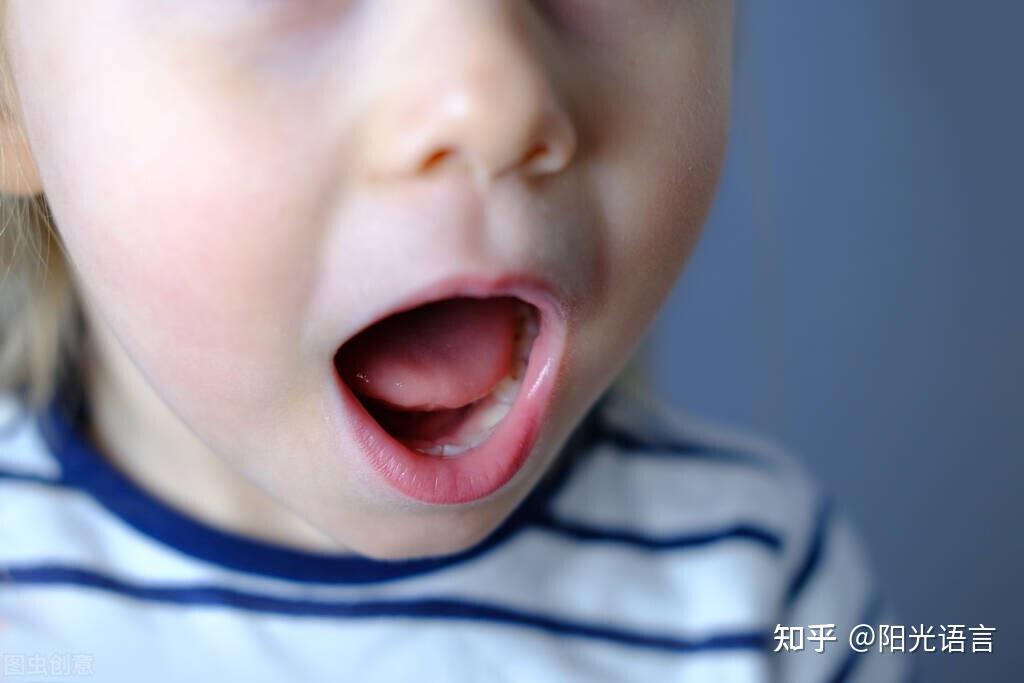 宝宝剪舌系带之后会怎样？家长必读 - 知乎