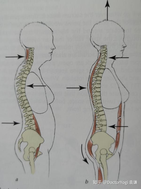 脊柱轴向延伸状态