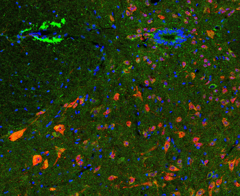 使用QuPath+Cellpose+StarDist分析蛋白入核比率 - 知乎