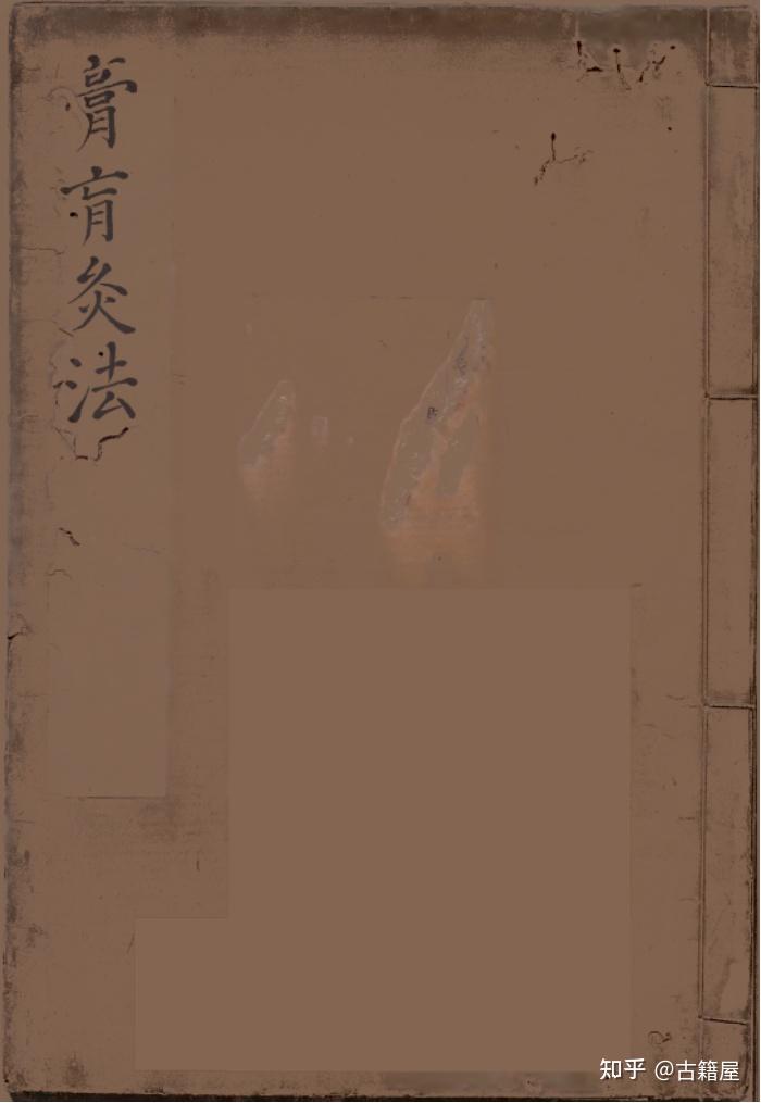 中医针灸著作《新刊庄季裕编灸膏肓腧穴法》明万历年王月轩抄本 - 知乎