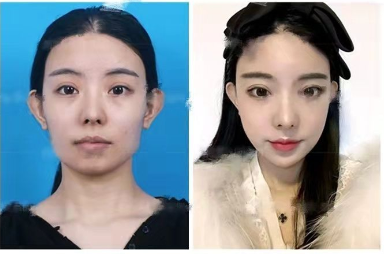 国内有哪些医院医生做削骨磨骨比较好北京地区有削骨医生推荐吗