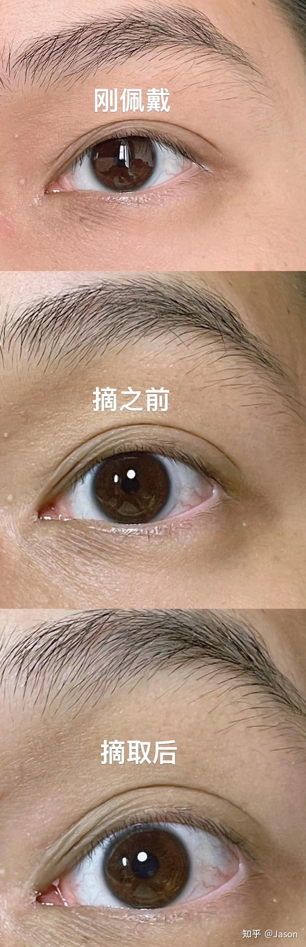 爱尔康水梯度日抛散光片（DAILIES TOTAL1 for Astigmatism）测评 - 知乎