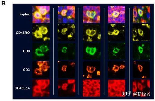 靶标分子检测 | 多重免疫荧光染色检测分析方案 - 知乎