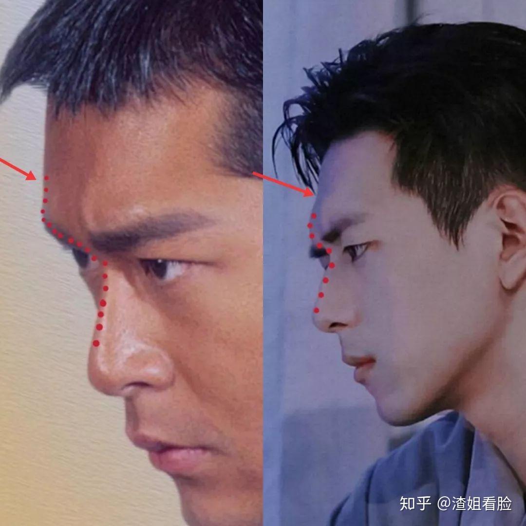 而李现的侧面轮廓劣势在于额丘不够饱满,还是同古天乐对比,箭头指向处