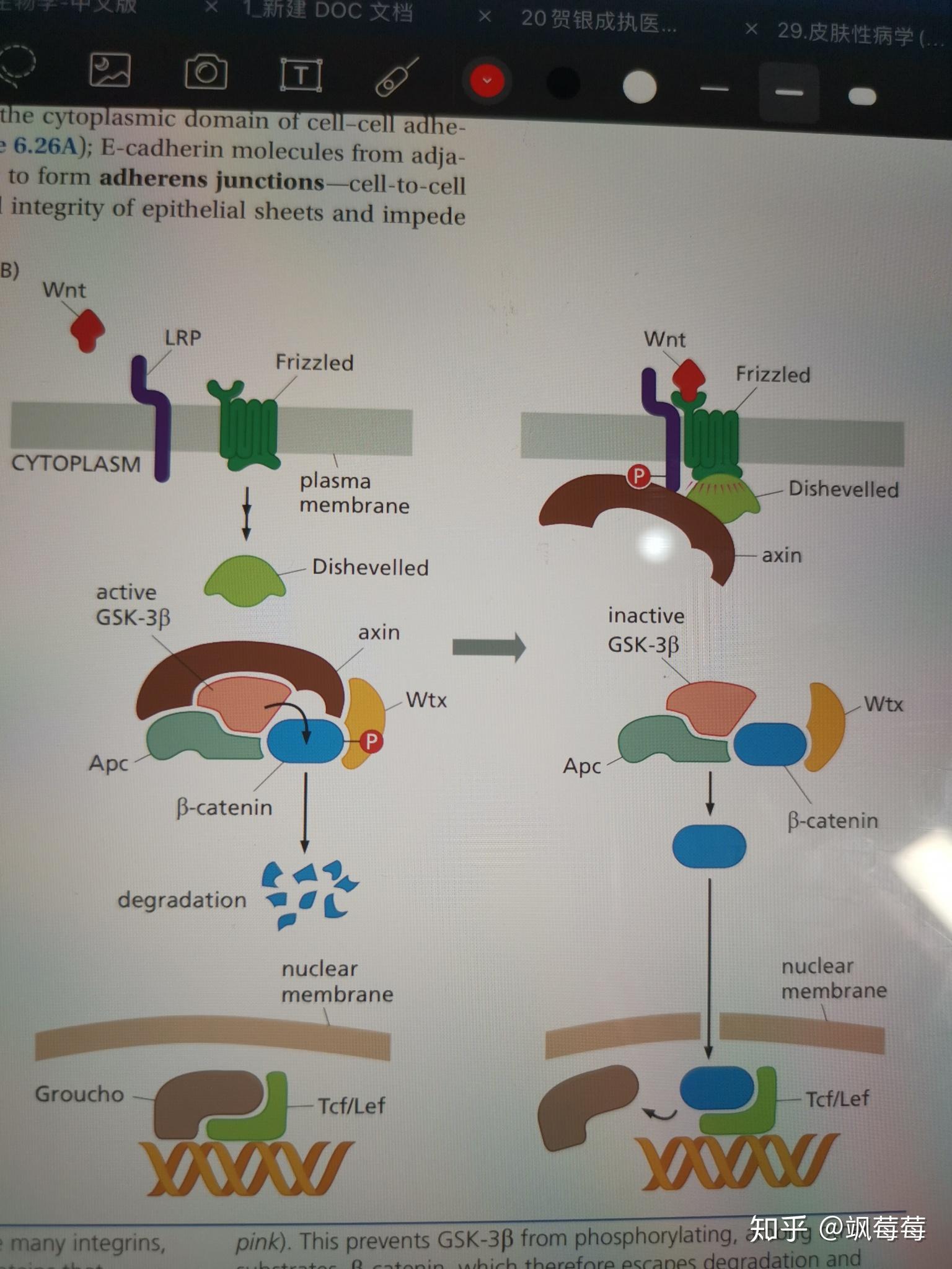 逃脱降解的β–catenin在胞浆和胞核里累积,入核便于tcl/lef转录因子