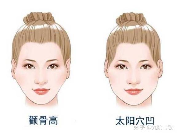 九院韦敏说,颧弓颧骨内推or磨骨,如何选择? - 知乎
