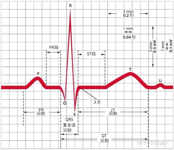 一期一會如何正確解讀心電圖檢查結果一