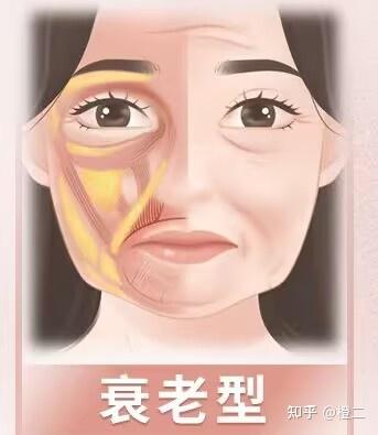 面颊凹陷、颧骨凸出、瘦脱相人群必看的自救指南！附对症处理方案 - 知乎