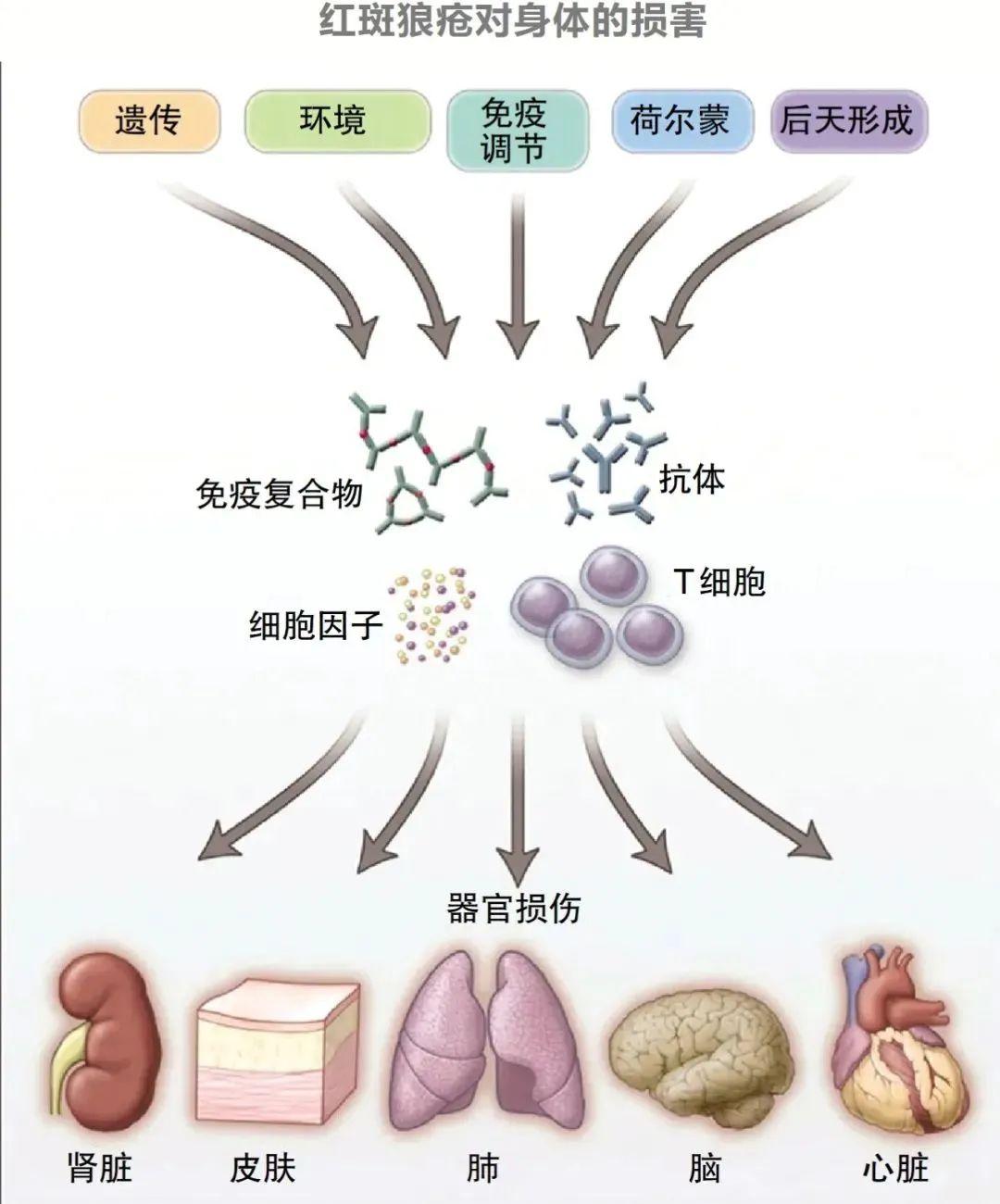 系統性紅斑狼瘡是一類慢性,反覆發作的自身免疫性疾病的總稱.