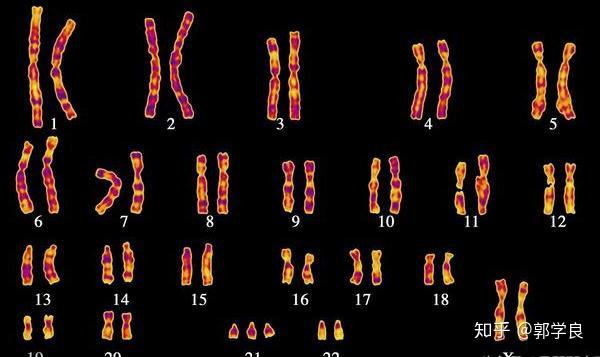胚胎三整倍体的原因是什么中美试管婴儿技术对比
