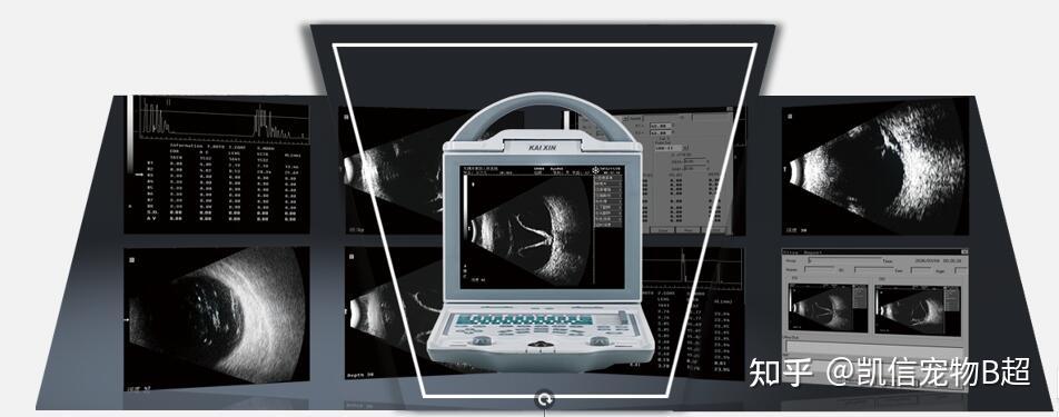 国产眼科ab超角膜测厚仪