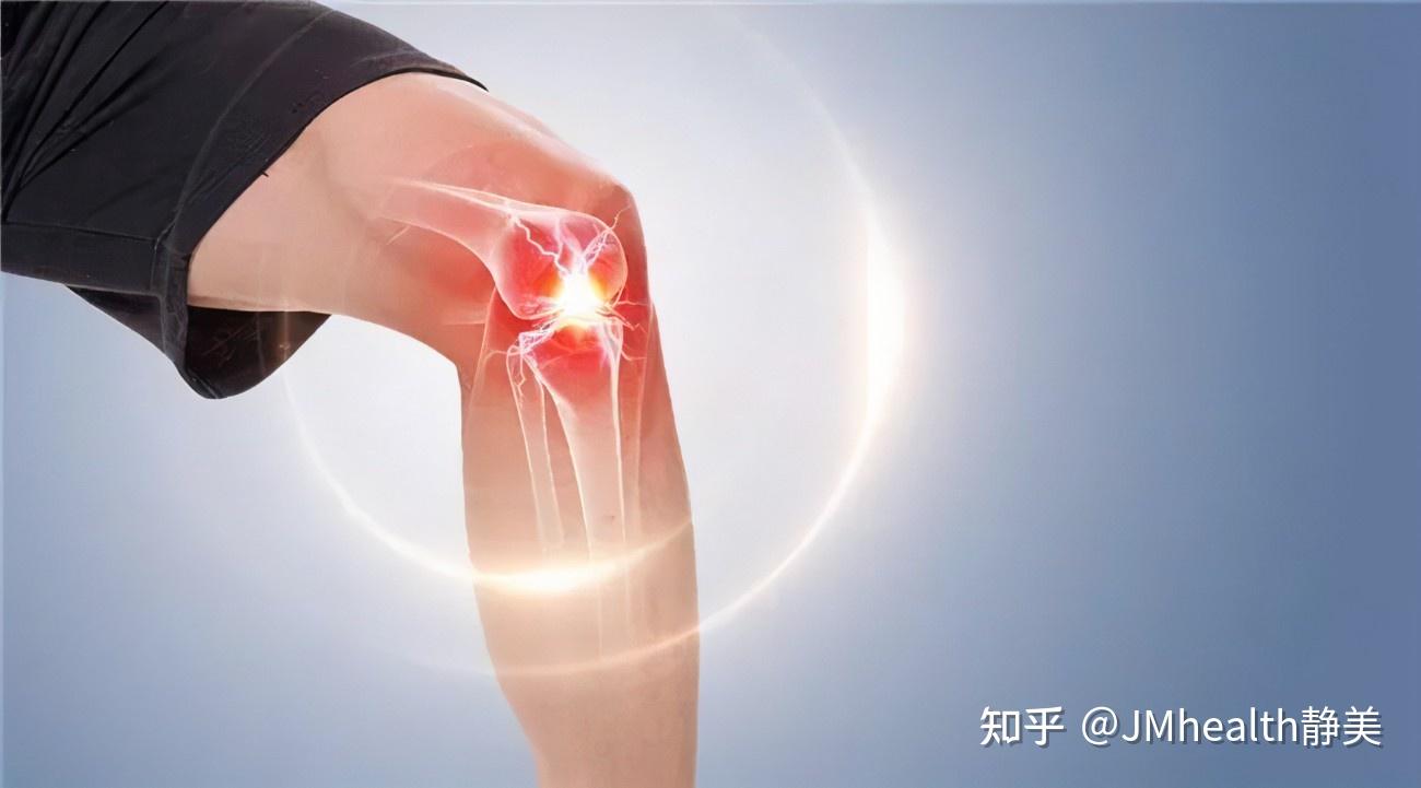 膝盖肿胀疼痛滑膜炎找上门要如何应对