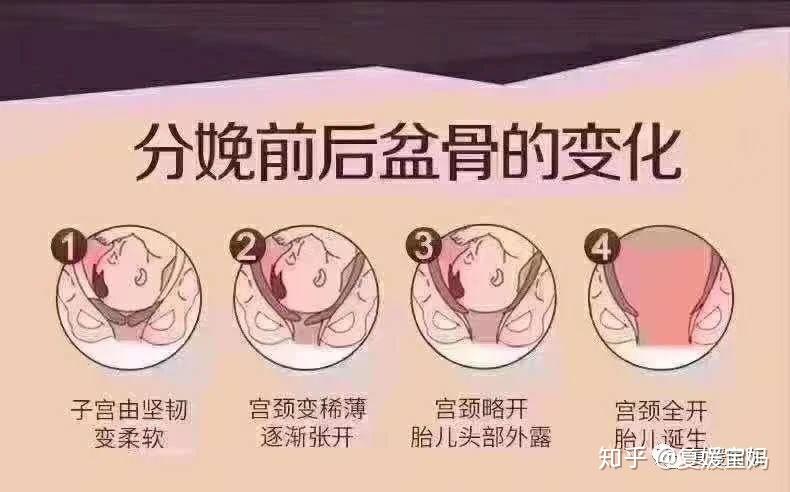 产后子宫恢复过程图图片