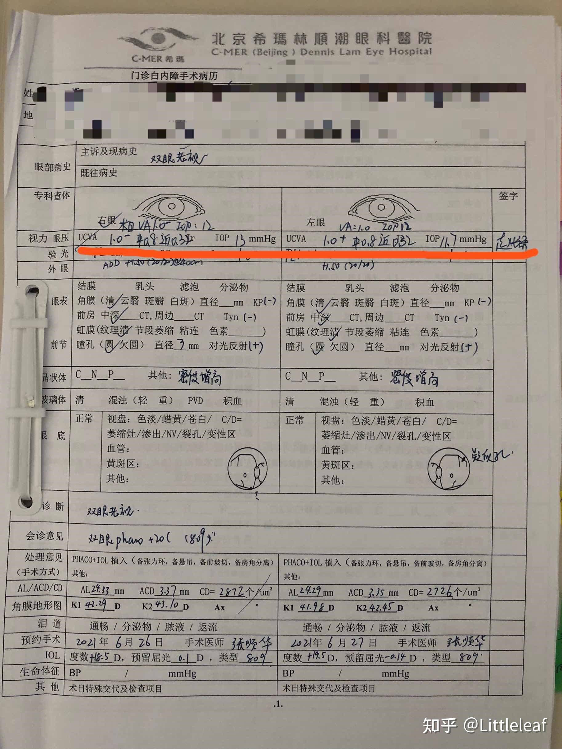 眼科OPD怎么读图希玛眼科医院再添“利器”助力屈光性白内障手术_https://www.jmylbn.com_新闻资讯_第3张