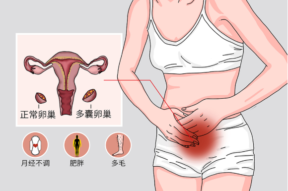 女性卵巢和肚脐位置图图片