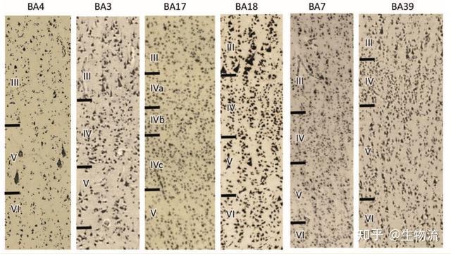 brodmann大脑分区和尼式染色