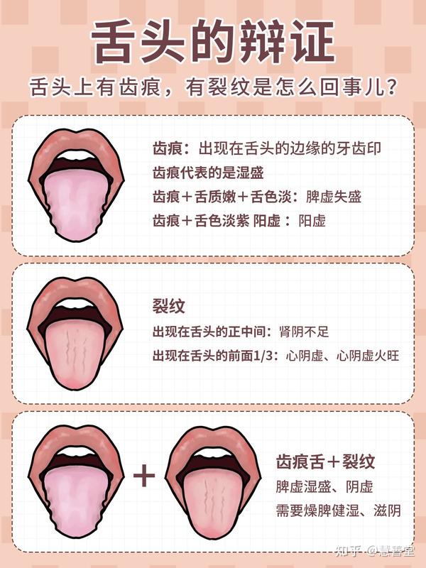 舌相的辩证||从舌头看全身的健康状况—慧善堂 - 知乎
