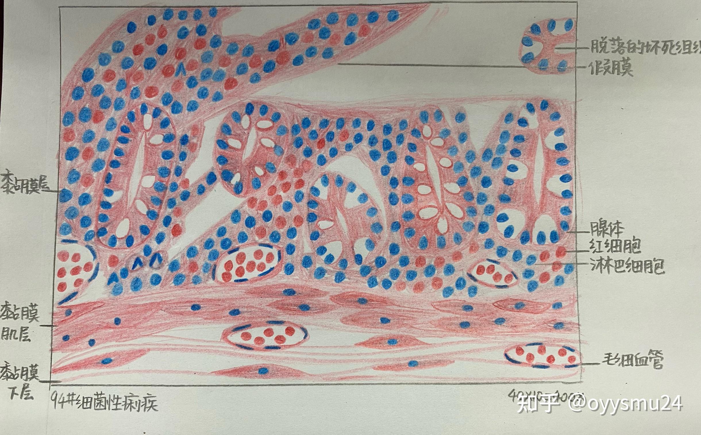 肝血吸虫病今学期的病理画图就这样结束了 ,后期因为自己也没什么耐心