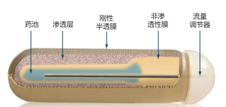 干货——你需要知道的ALZET可植入式渗透压泵知识 - 知乎