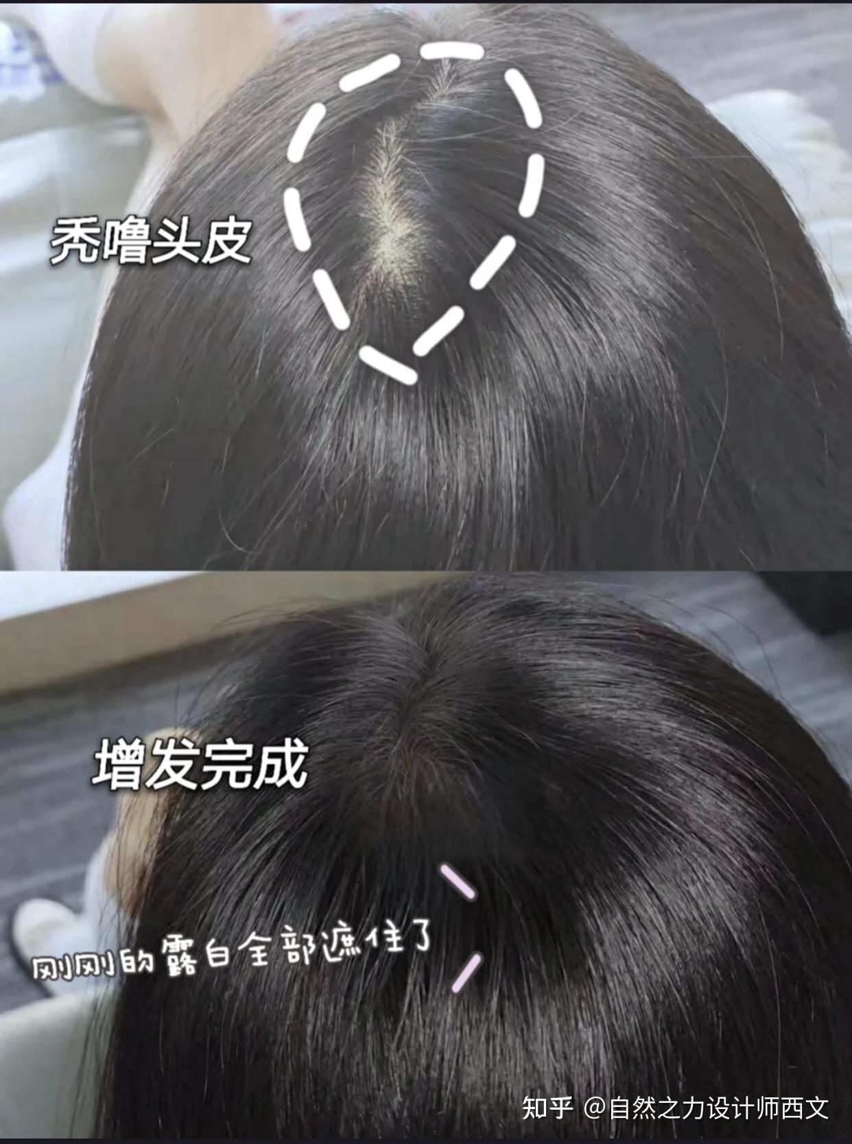 不可不知的养发护发小常识 - 知乎