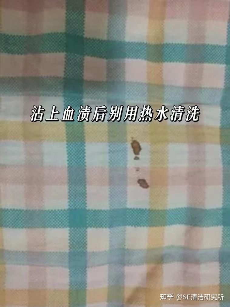 姨妈血渍沾到衣物上正确打开方式 - 知乎