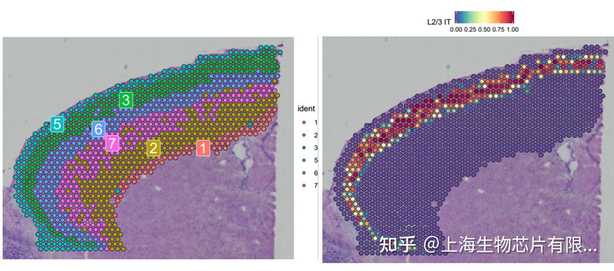 是趋势也是必然空间转录组和单细胞转录组测序联合应用的典型案例