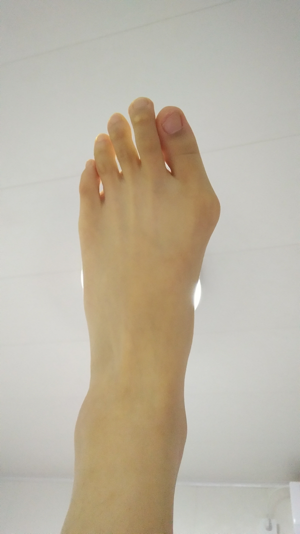 女生有大脚骨,是一种怎样的体验?
