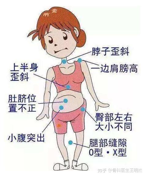 骨盆旋移综合征的手法临床查体