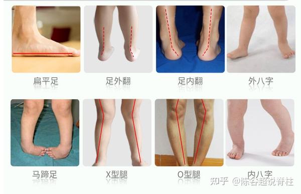 足球比賽時(shí)長(zhǎng)的影響力及其對(duì)策略和結(jié)果的塑造