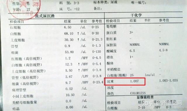 2.尿蛋白加減號,降到多少是達標?