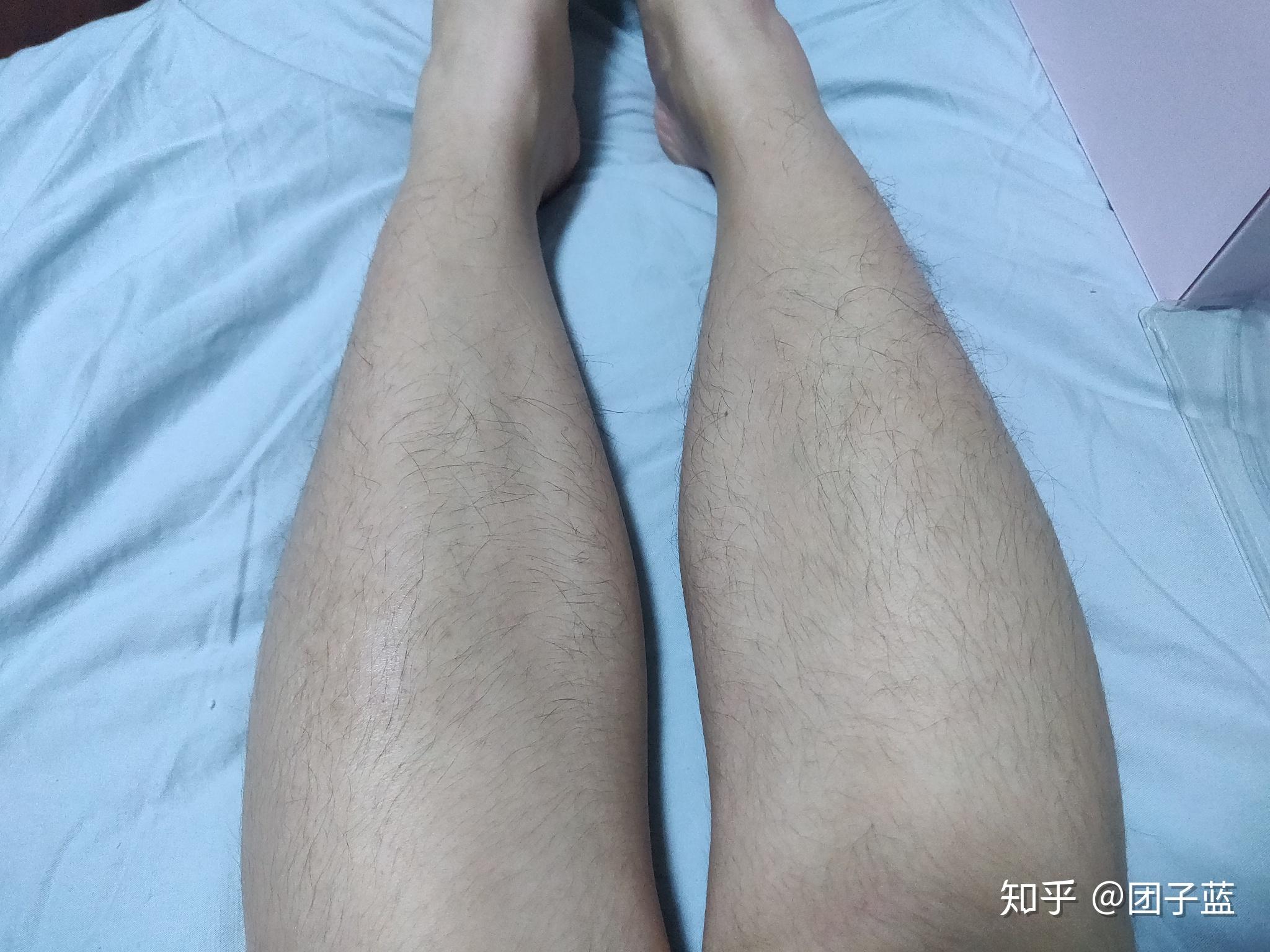 26 剃完左胳膊毛毛后想起来没有拍照,那今天就只弄这一个胳膊叭,剩下