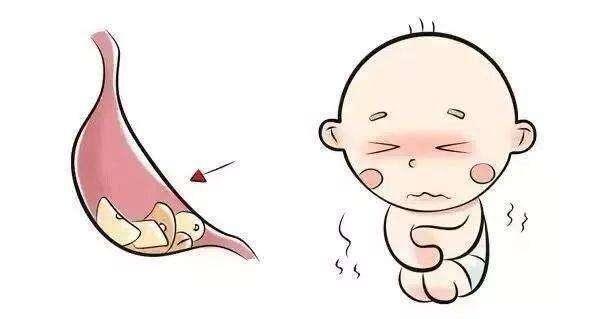 什么是疳积、小孩子怎么预防疳积？ - 知乎