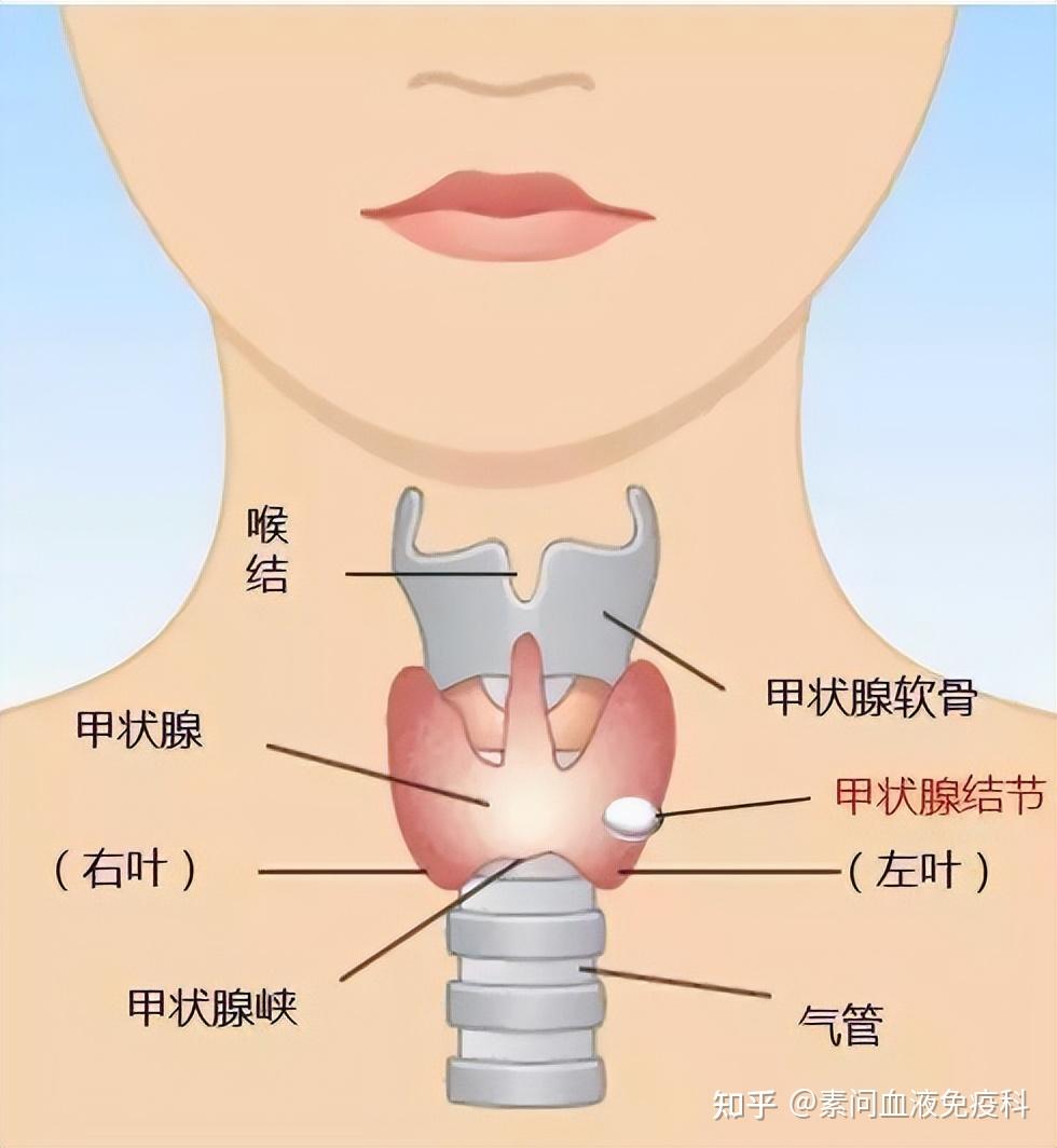 三级甲状腺结节