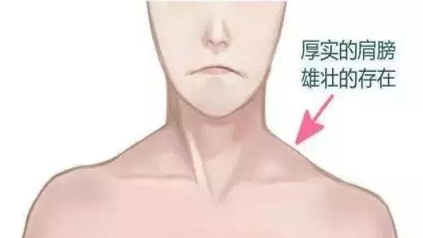 什么方法可以改善斜方肌 v2-86b146fe33a156c7dfe8a7bb72e1424f_r.jpg