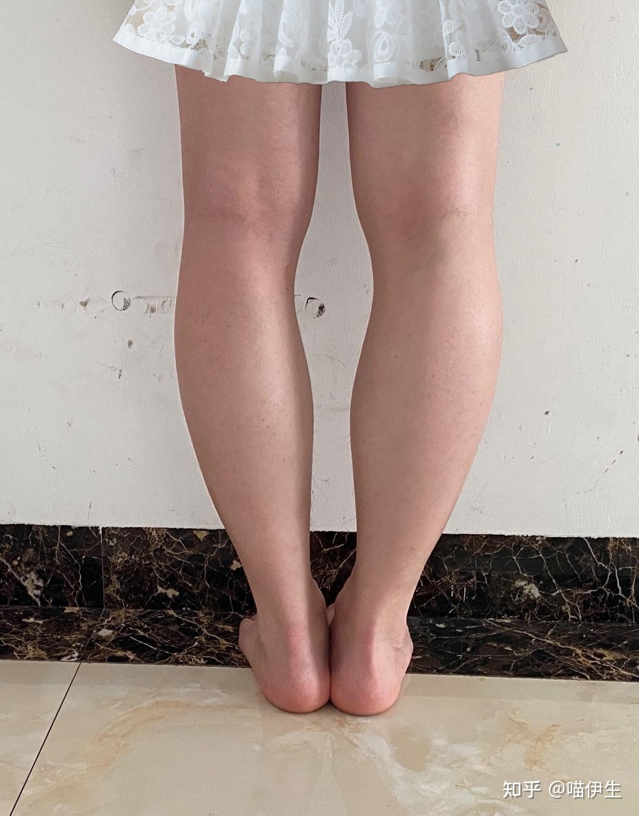 美女腿部减肥瘦身瘦腿实拍图摄影图高清摄影大图-千库网