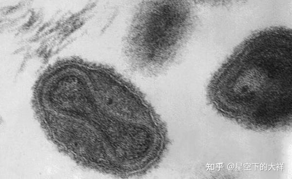 历史上的今天——证实牛痘对天花免疫 - 知乎
