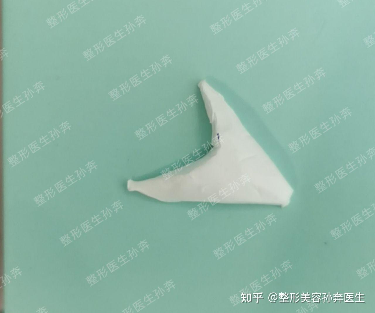 鼻基底假体形态是什么样的