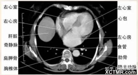 【收藏】胸、腹、盆腔 CT解剖详解 - 知乎