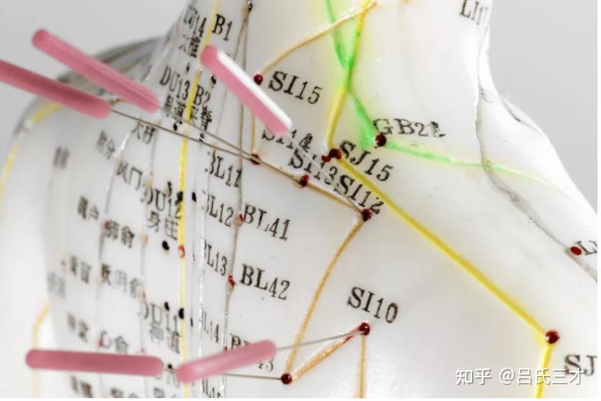 收藏!常见癌症的配穴应用 - 知乎